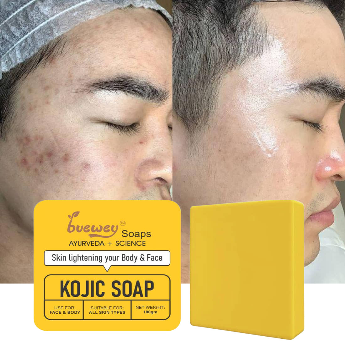 BUEWEY Beauty Kojic soap for hyperpigmentation Soap for All Skin Type ( Pack of 1 )