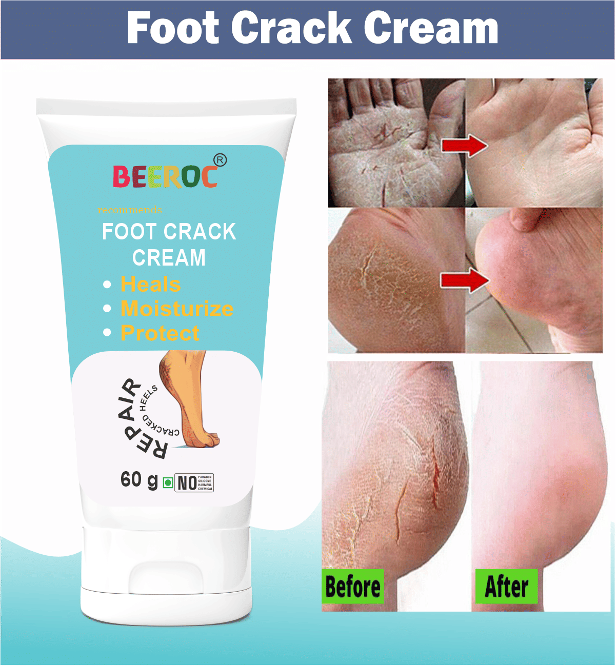 BEEROC Cracked skin repair Cream for All year ( 60 g )