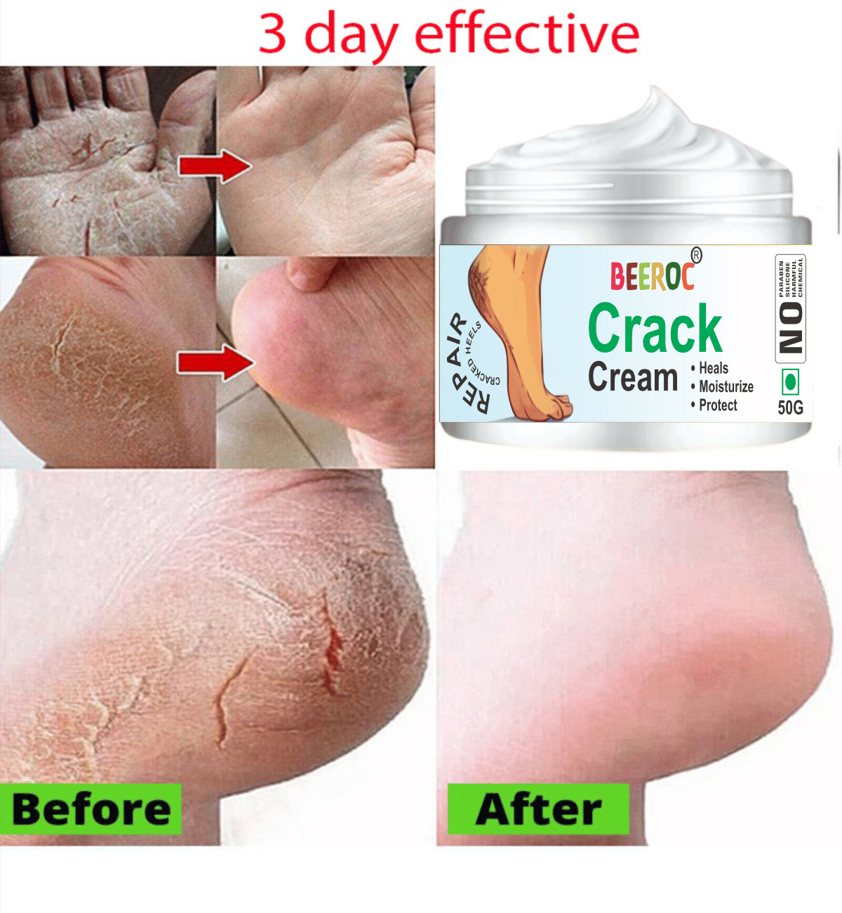BEEROC Cracked skin repair Cream for ( 50 g )