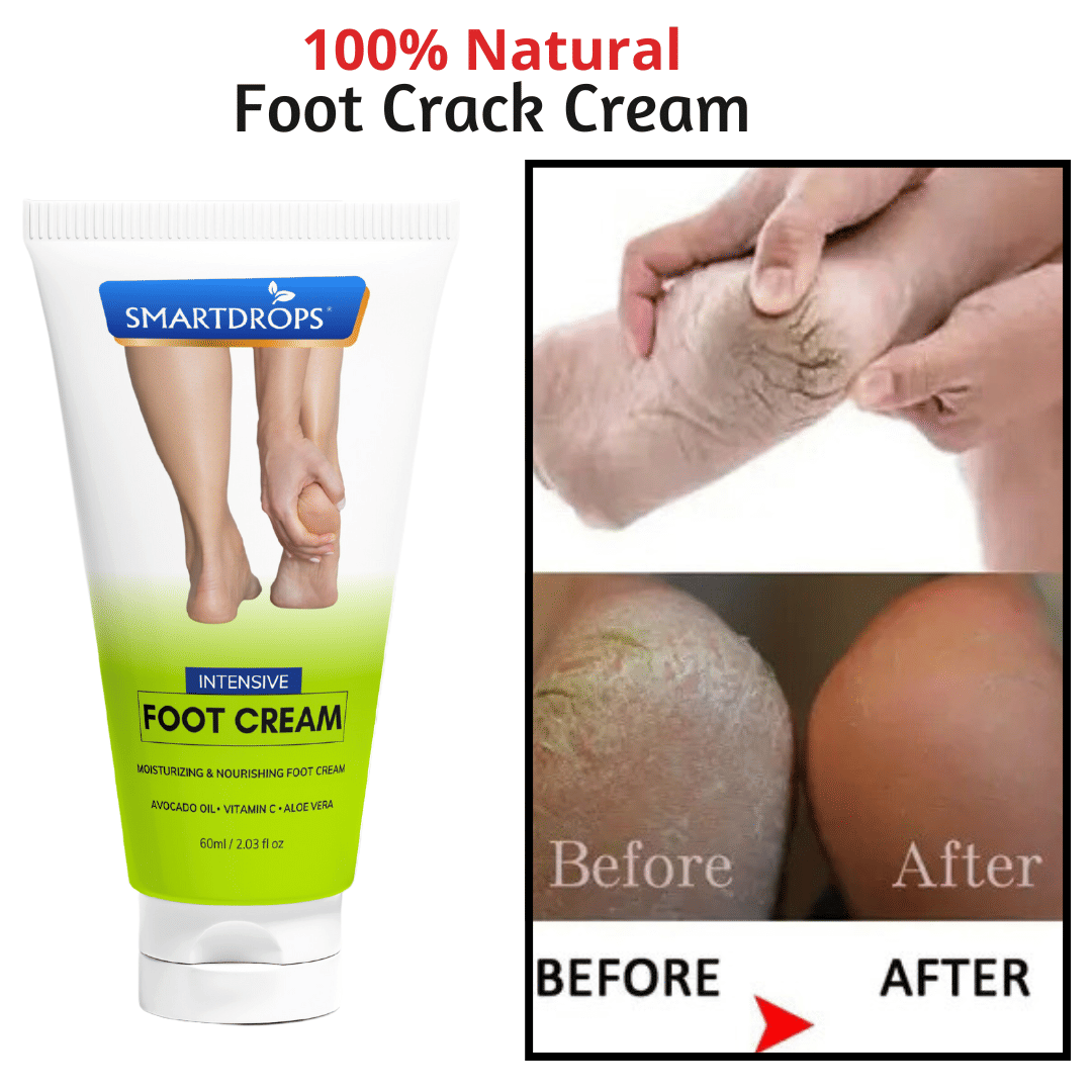    			Smartdrops Anti Itch Cream for ( 60 mL )