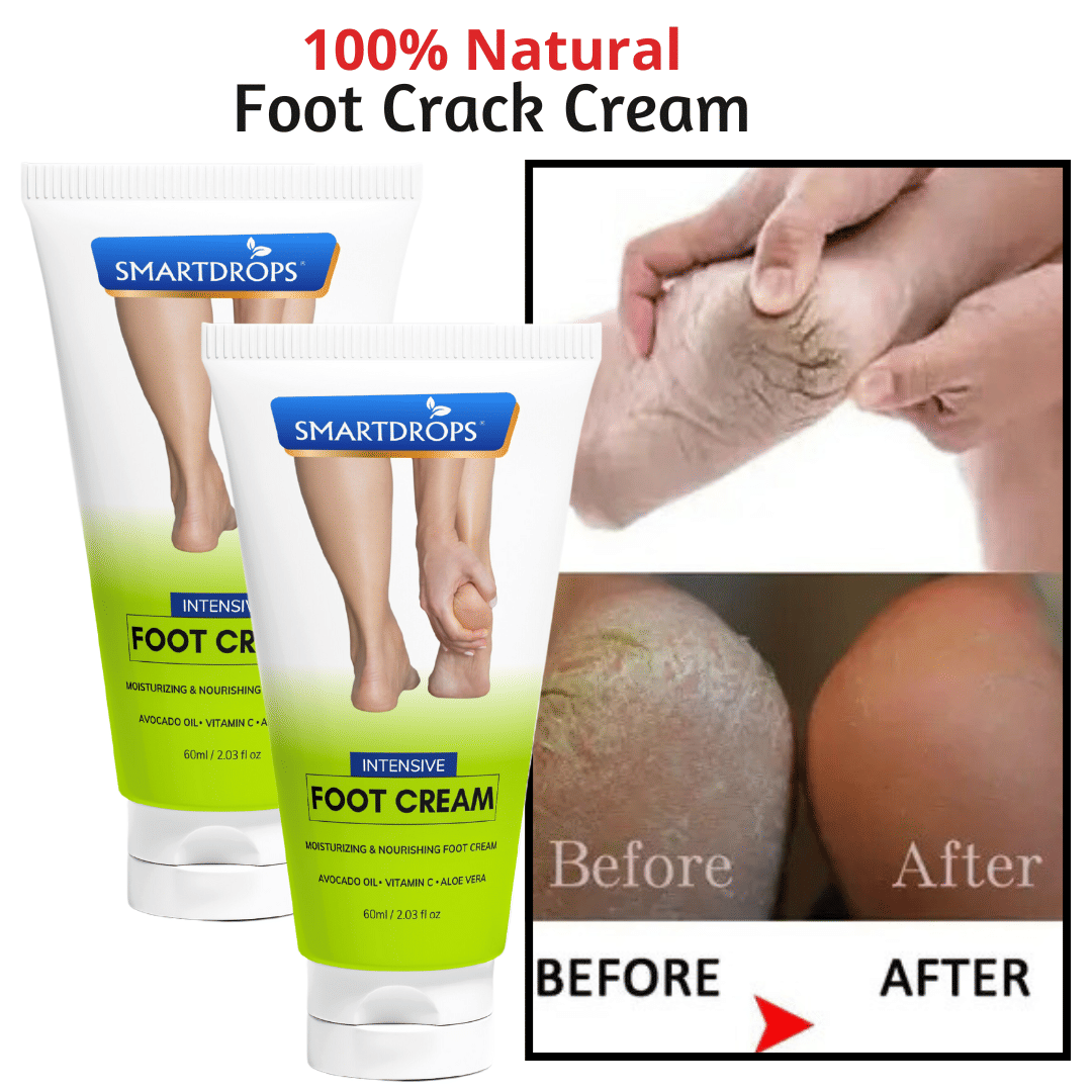 Smartdrops Removes Patches Cream for ( 120 mL ) Pack of 2 Smartdrops Removes Patches Cream for ( 120 mL ) Pack of 2