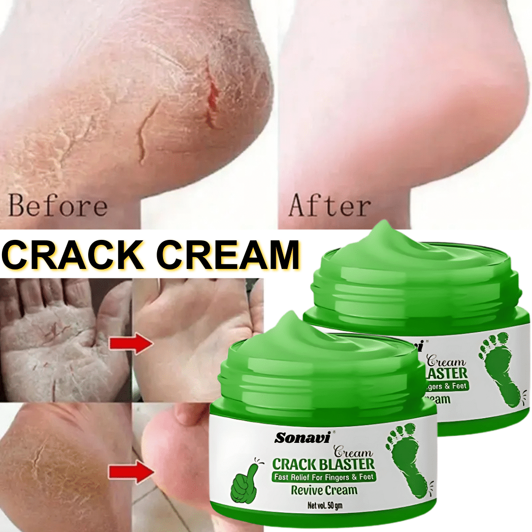     			Sonavi Removes Patches Cream for ( 100 g ) Pack of 2