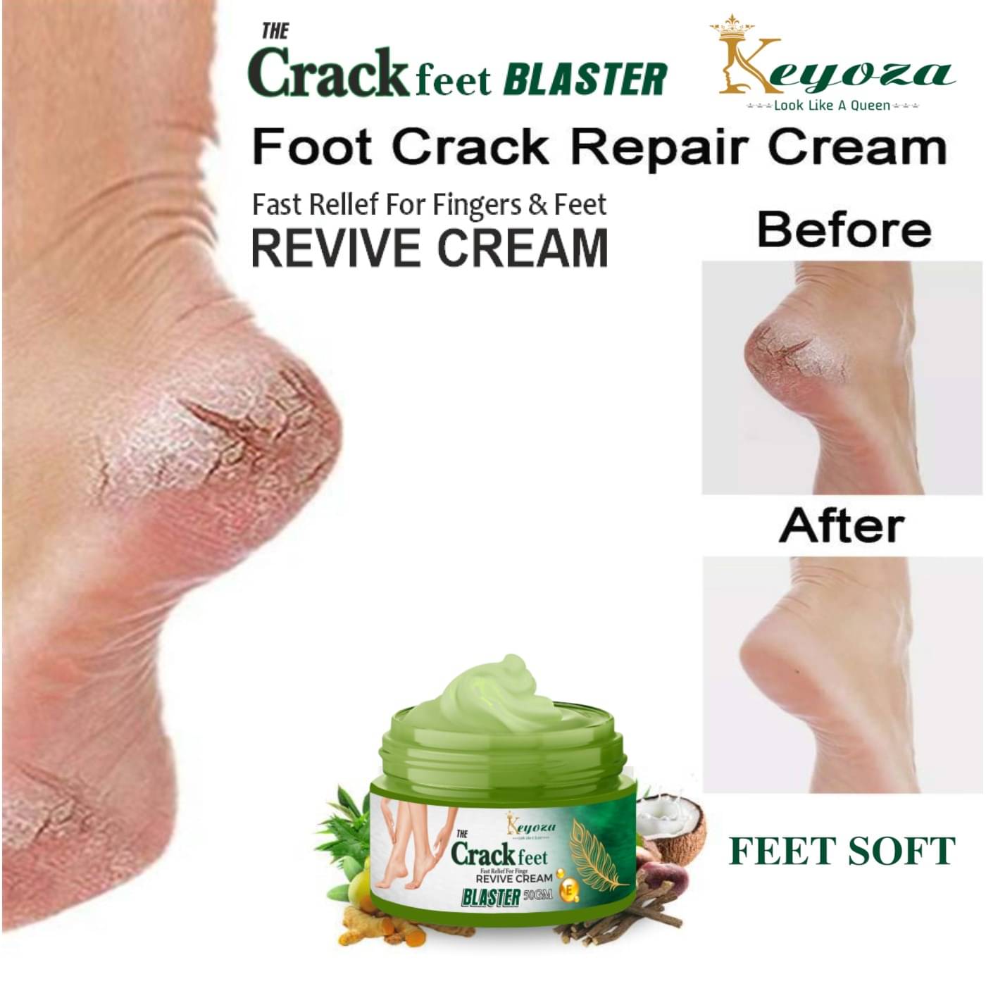     			Keyoza Cracked skin repair Cream for Winter ( 50 g )