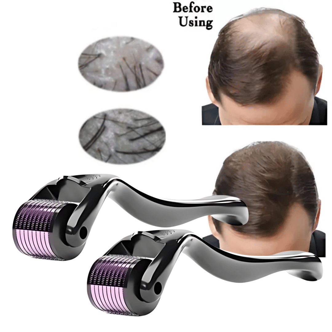 Derma Roller 0.5mm Titanium Alloy 540 Micro Needles For Scalp & Beard Derma Roller 0.5mm Titanium Alloy 540 Micro Needles For Scalp & Beard