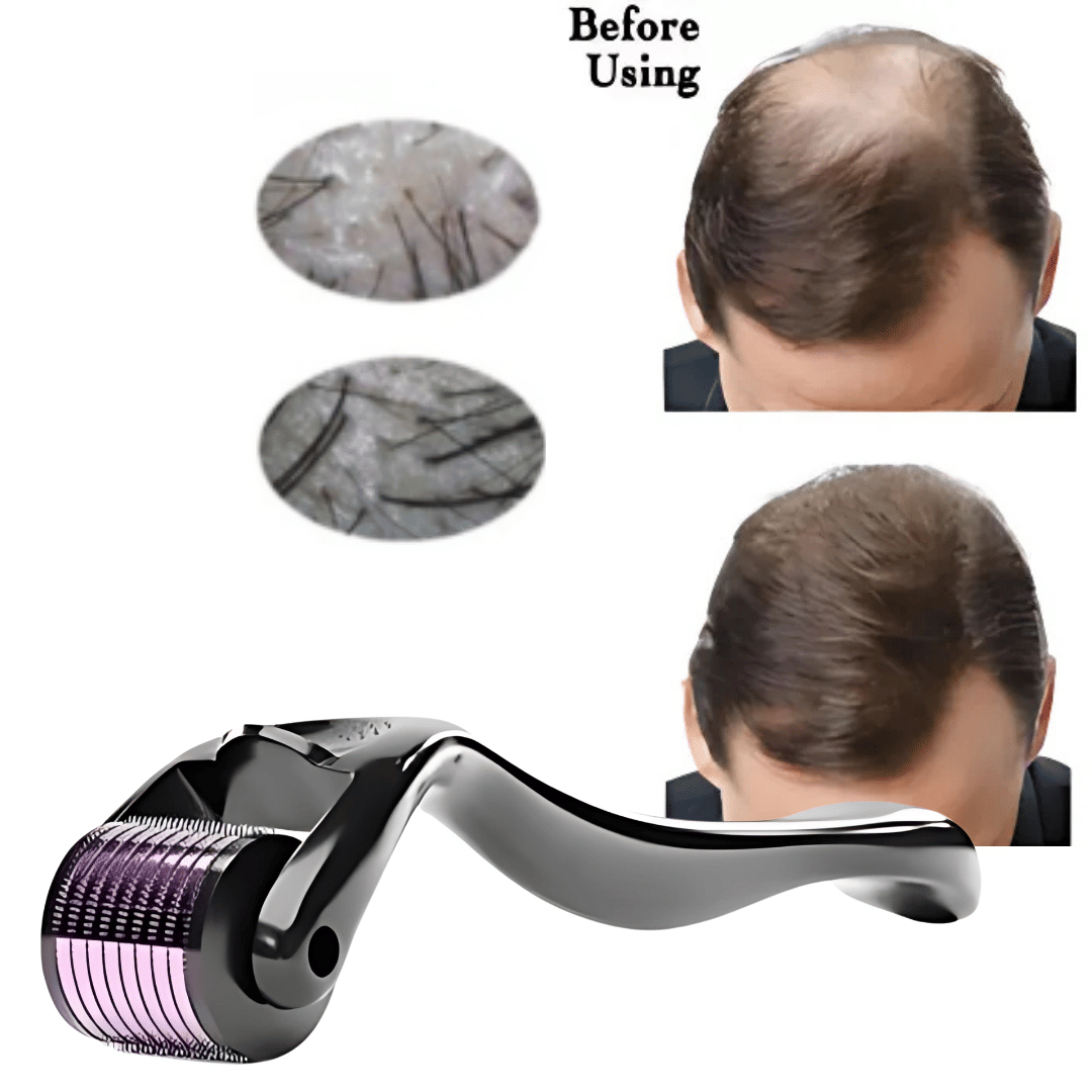 Derma Roller for Hair Growth Wrinkles  Face Microdermabrasion | 0.5mm Titanium Alloy 540 Micro Needles For Scalp & Beard