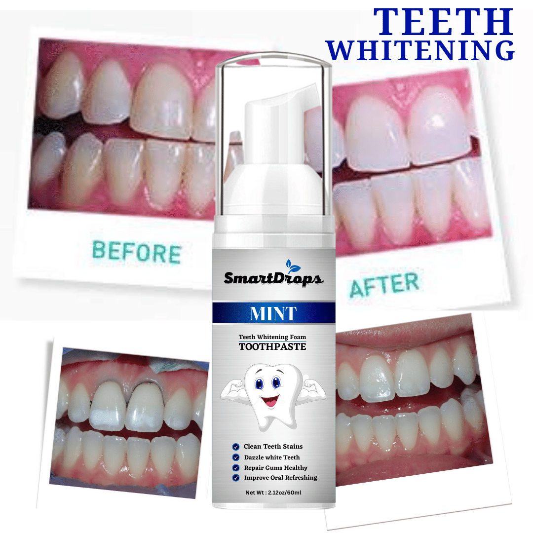 Smartdrops Whitening Toothpaste Pack of 1 Smartdrops Whitening Toothpaste Pack of 1