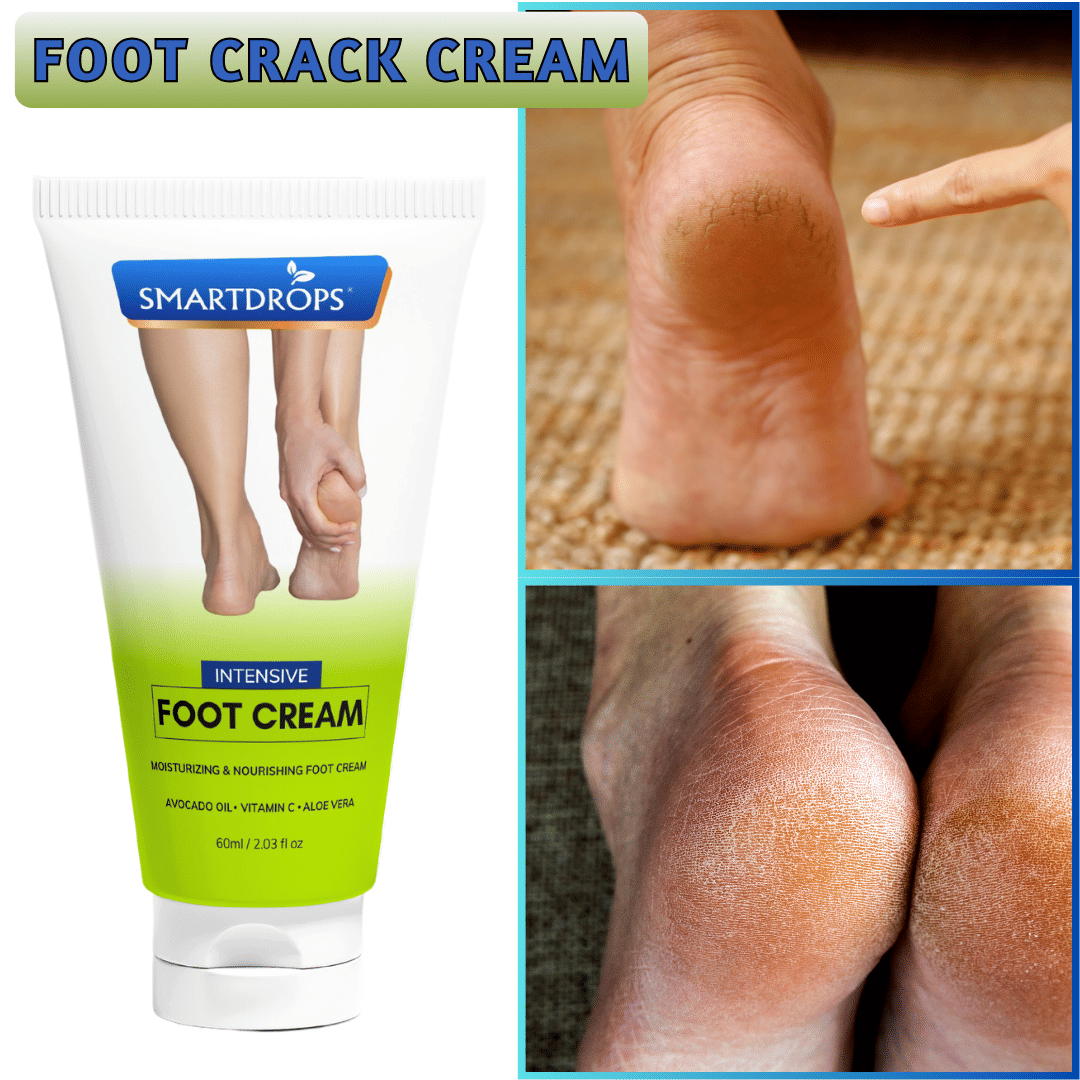     			Smartdrops Removes Patches Cream for ( 60 mL )