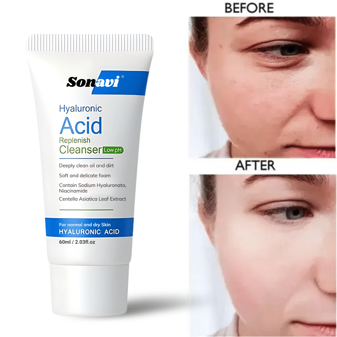 Smartdrops - Acne or Blemishes Removal Face Wash For All Skin Type ( Pack of 1 ) Smartdrops - Acne or Blemishes Removal Face Wash For All Skin Type ( Pack of 1 )