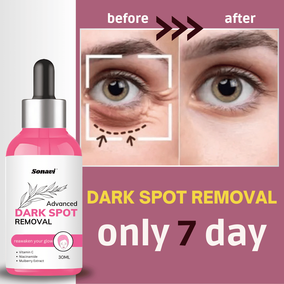     			Sonavi Face Serum Niacinamide Fairness For All Skin Type ( Pack of 1 )