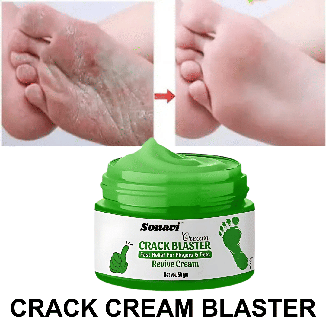    			Sonavi Callus Removal Cream for All year ( 50 g )