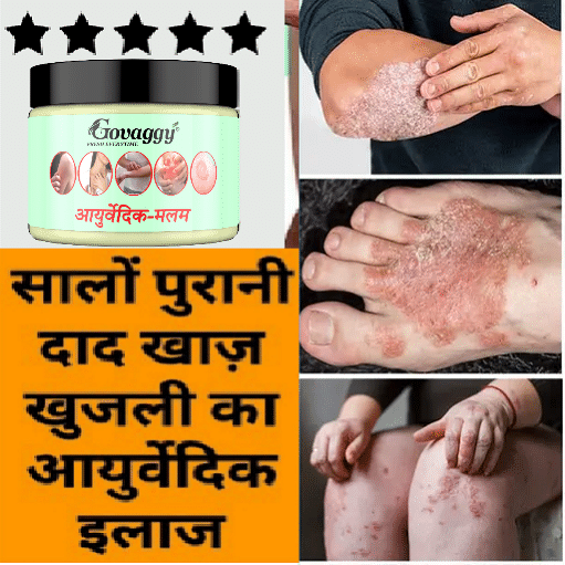     			GOVAGGY Ayurvedic Anti Fungal Cream 25 gm Pack Of 1