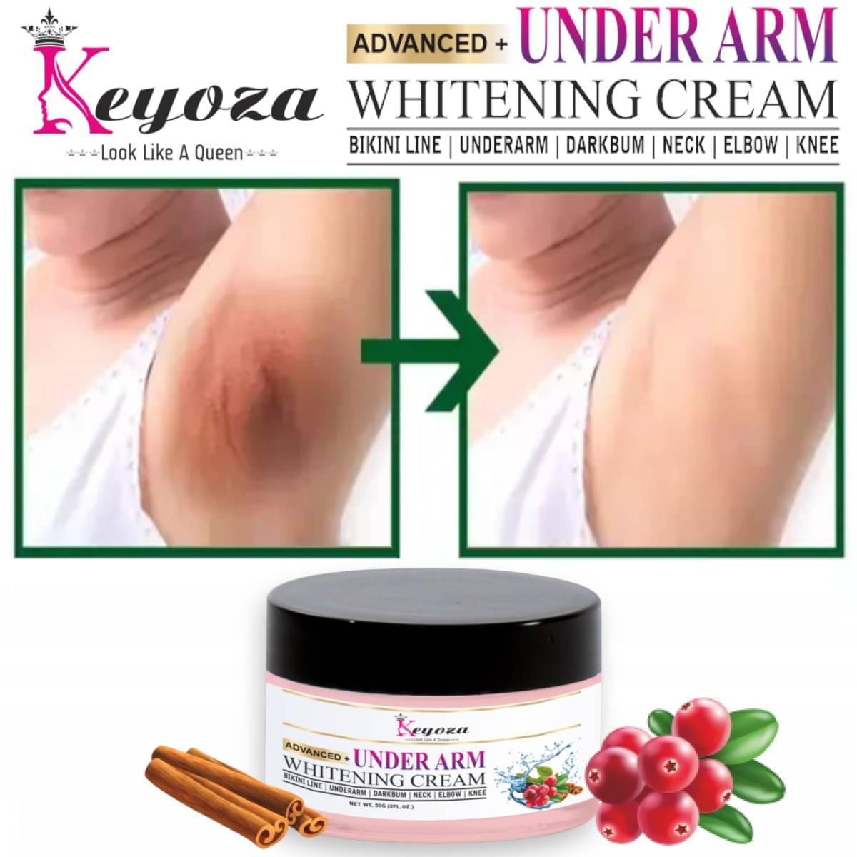     			Keyoza Black & White Head Removal Cream Fruity ( 50 g )