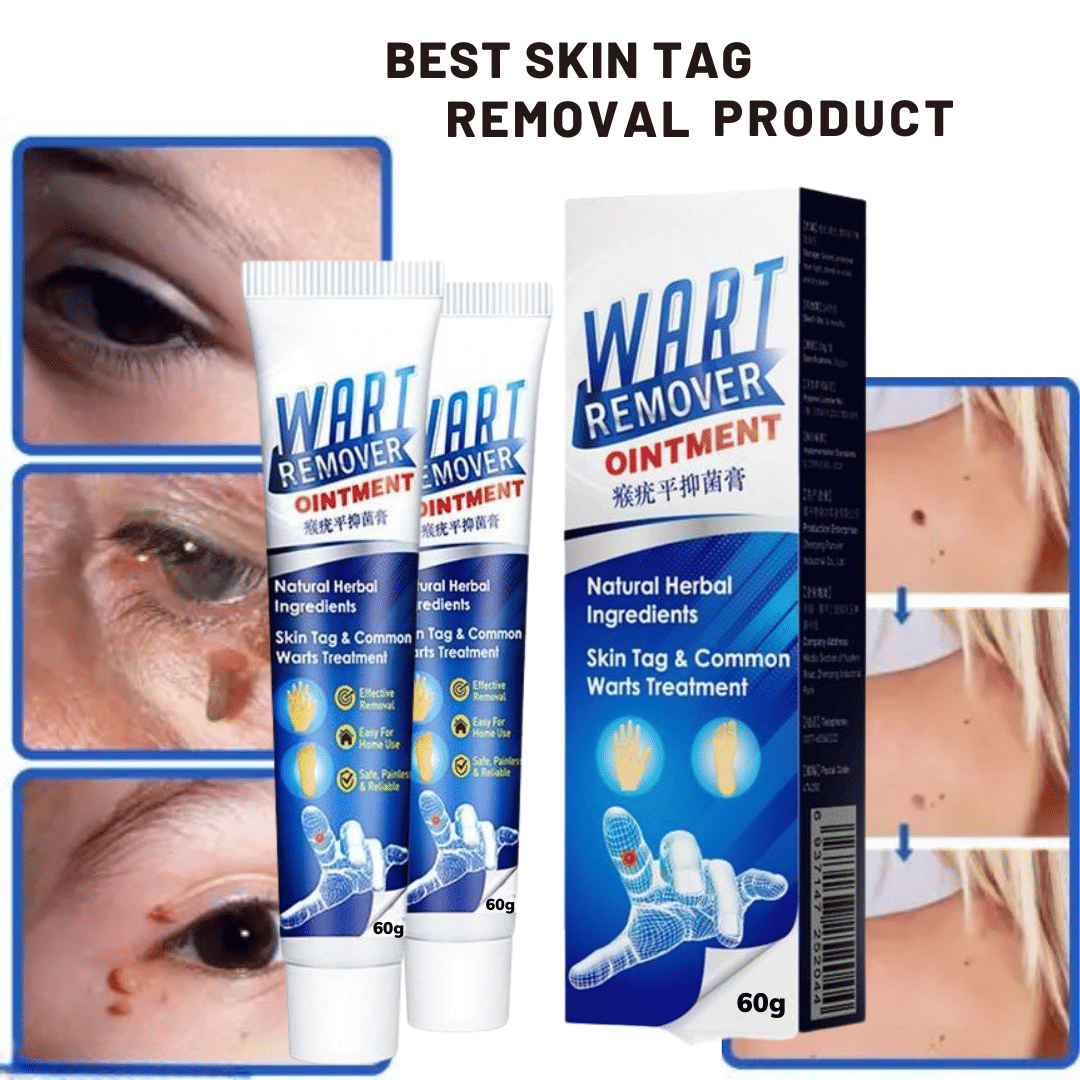 Massa Cream for Remove Warts Blackhead Remover