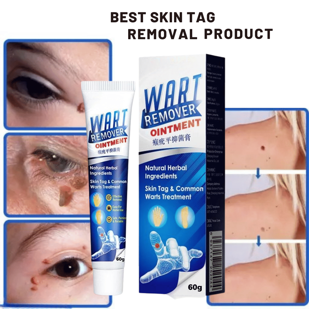 Massa Cream for Remove Warts Blackhead Remover