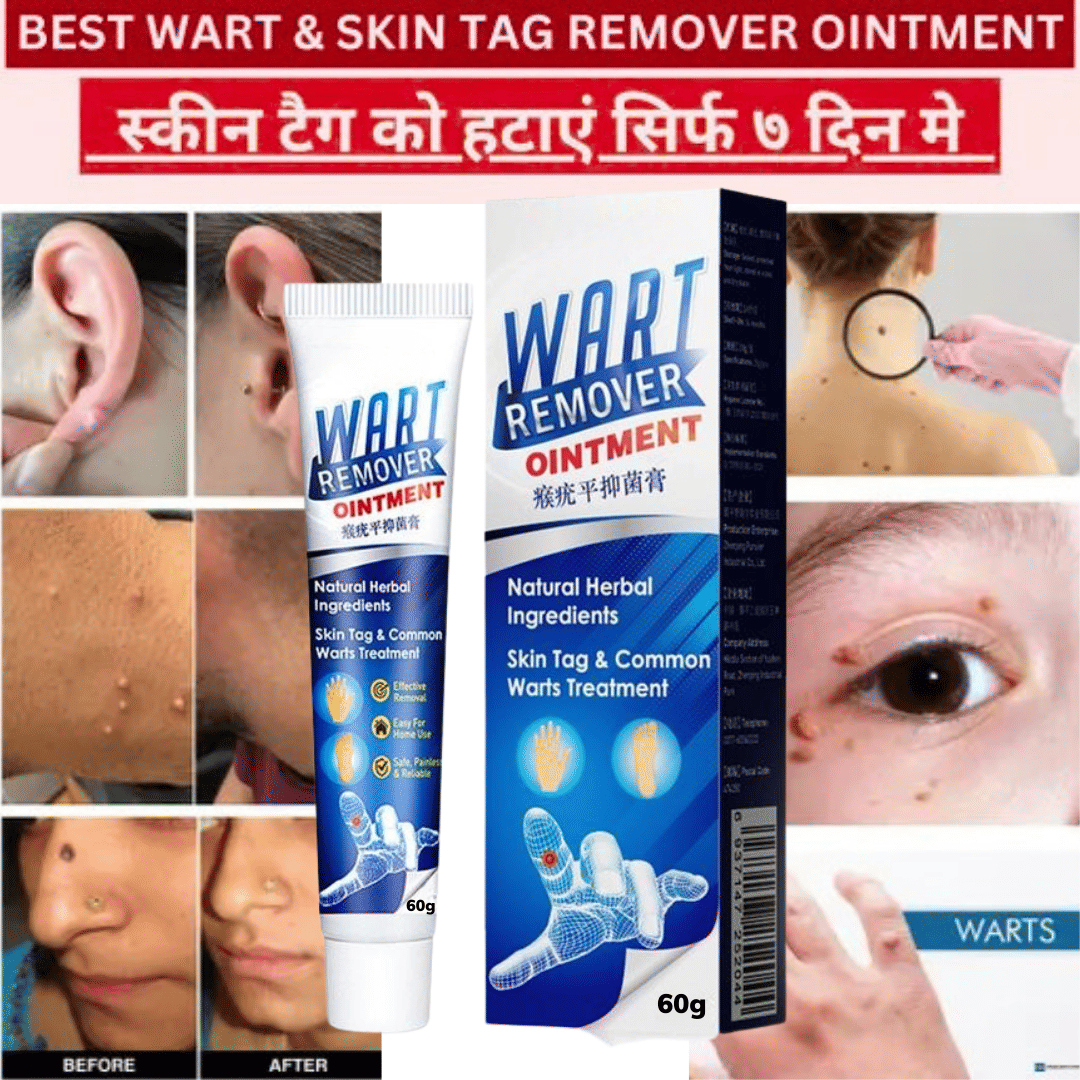 Massa Remover Cream for  Warts Safely Painless Cream Skin Treatment