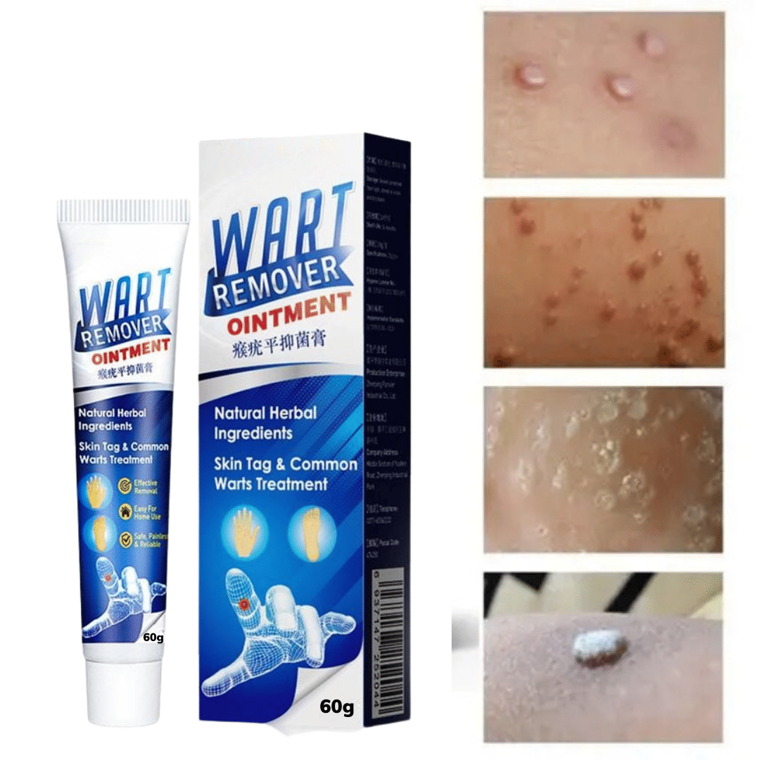 Massa Remover Cream for  Warts Safely Painless Cream Skin Treatment