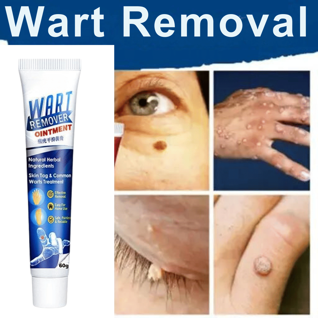 Massa Wart Remover Cream For Skin For Wart Free Skin For Men Or Women     			Massa Wart Remover Cream For Skin For Wart Free Skin For Men Or Women