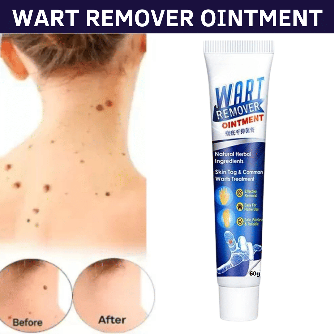 Massa Wart Remover Cream For Skin For Wart Free Skin For Men Or Women