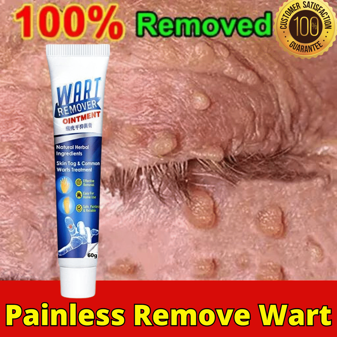 Massa Wart Remover Cream For Skin For Wart Free Skin For Men Or Women