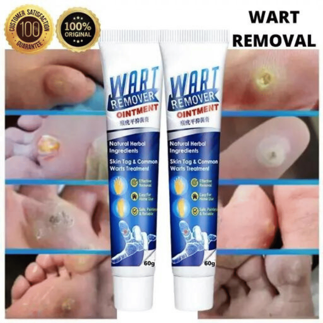 Massa Wart Remover Cream For Skin For Wart Free Skin For Men Or Women