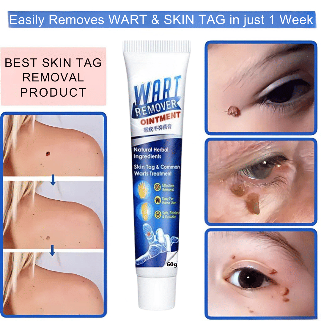 Remover Wart Without Leaving scars and refuse to repeat All Skin Type Use For Men And Women