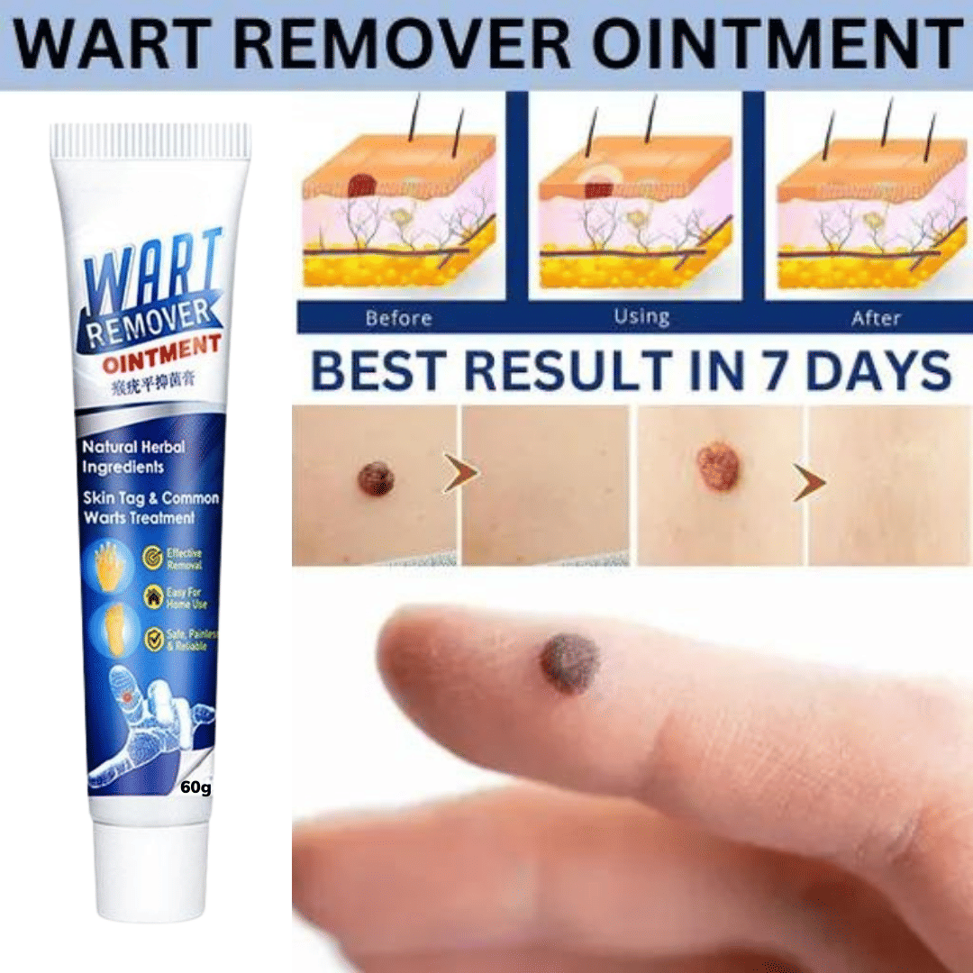 Remover Wart Without Leaving scars and refuse to repeat Herbal Ingrediants All Skin Type Use For Men And Women Remover Wart Without Leaving scars and refuse to repeat Herbal Ingrediants All Skin Type Use For Men And Women