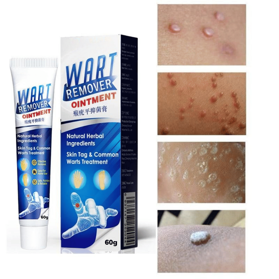 Remover Wort Without Leaving scars and refuse to repeat All Skin Type Use For Men And Women
