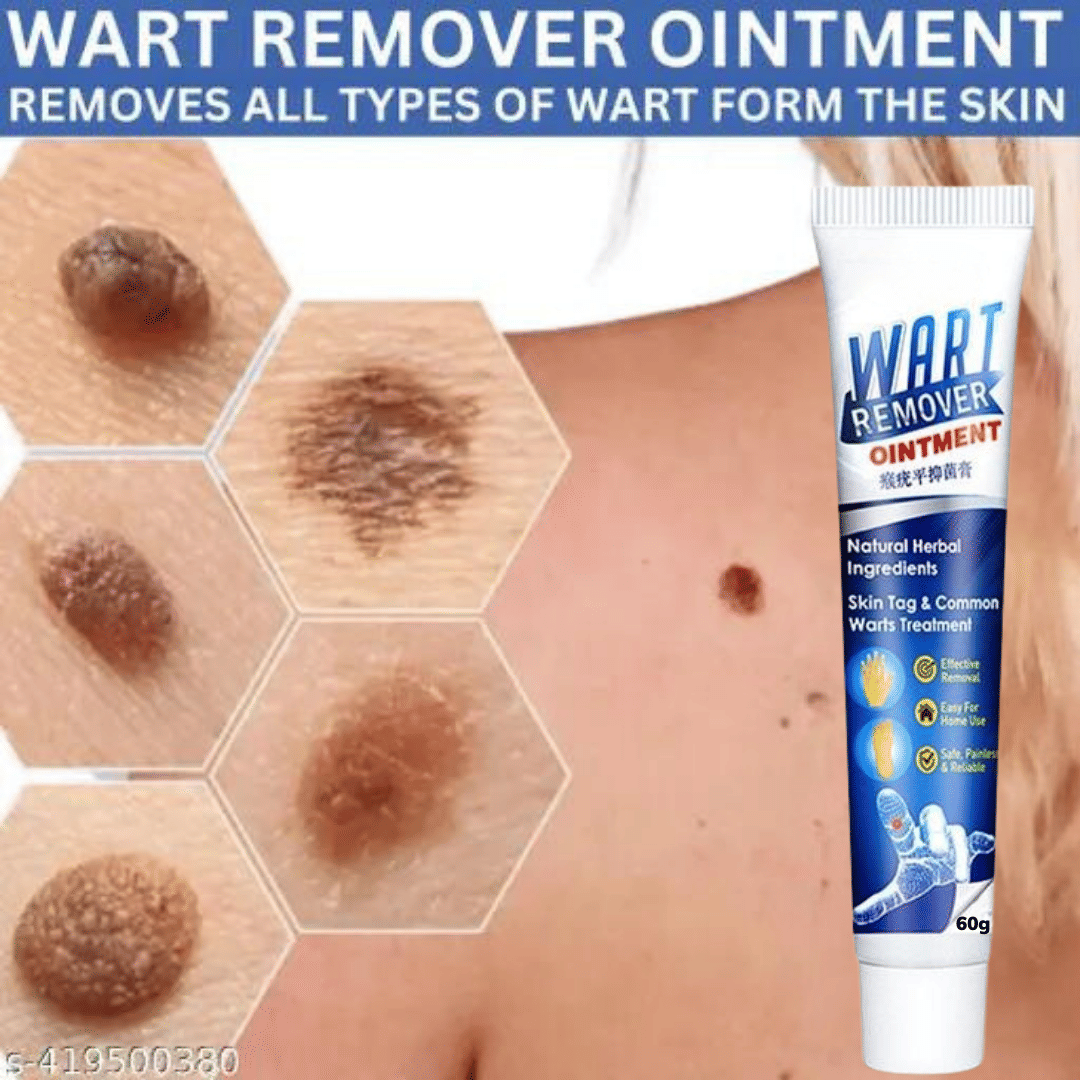 Wart Removal Ointment Skin Treatment