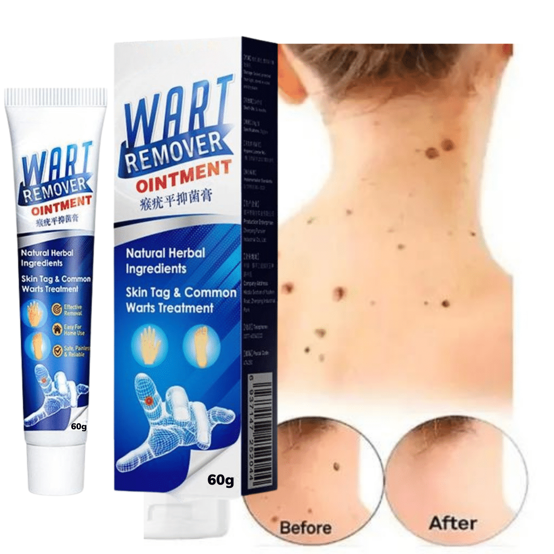     			Wart Removal Ointment Skin Treatment