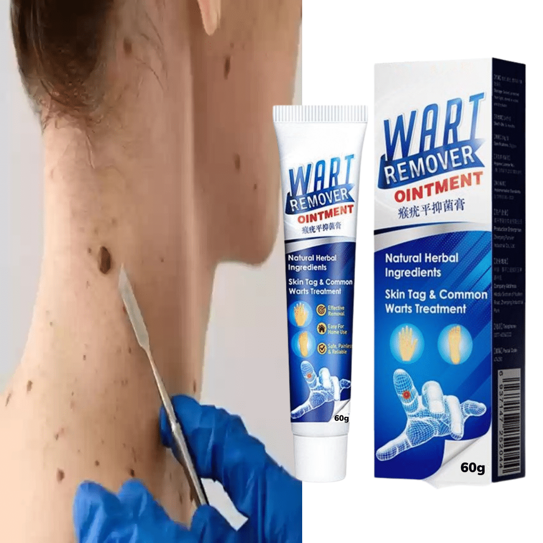     			Wart Removal Ointment Skin Treatment