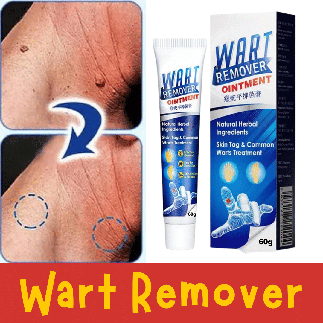 Wart Removal Ointment Treatment for Remove Warts Moles & Acne Safely Painless     			Wart Removal Ointment Treatment for Remove Warts Moles & Acne Safely Painless