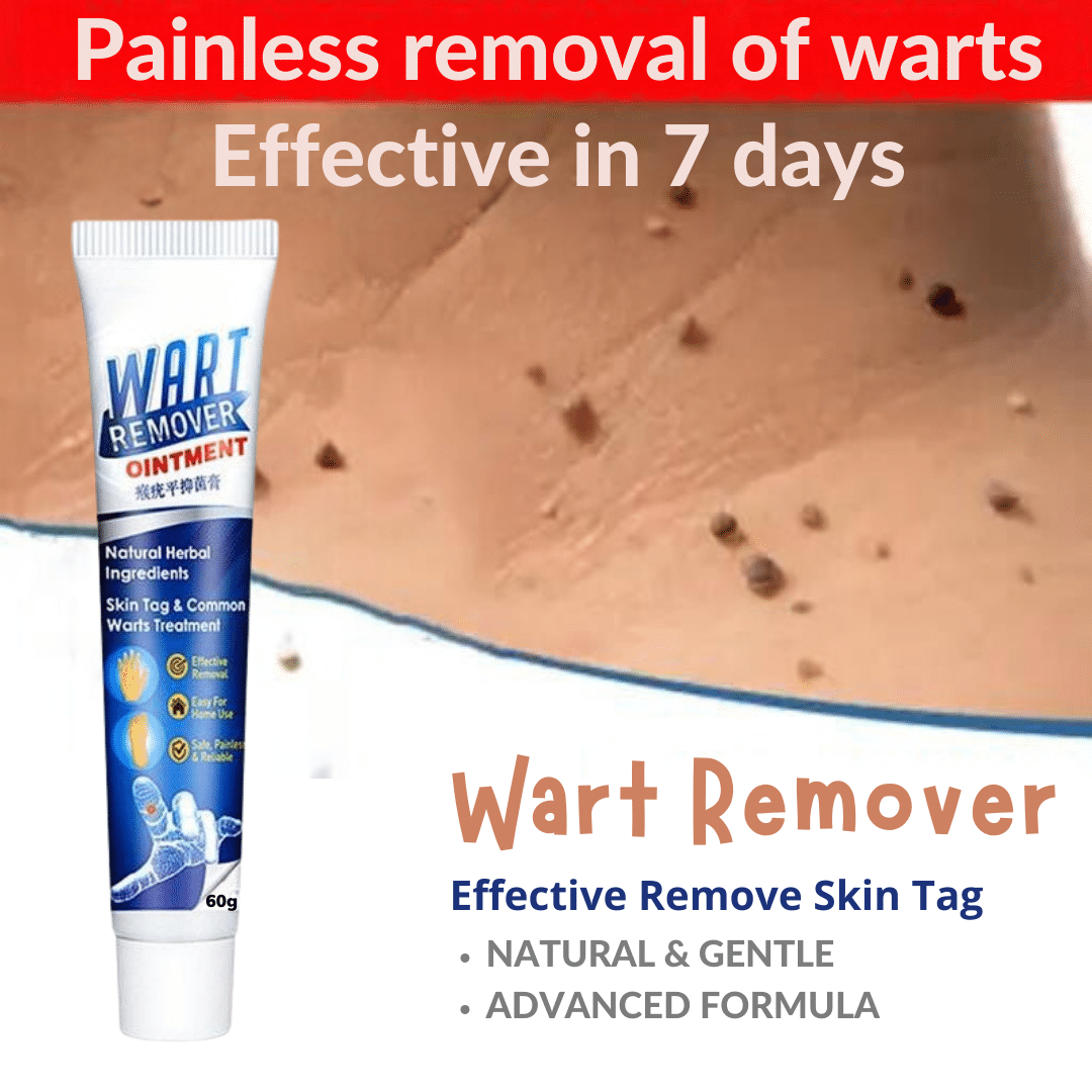 Wart Removal Ointment Treatment for Remove Warts Moles & Acne Safely Painless Wart Removal Ointment Treatment for Remove Warts Moles & Acne Safely Painless