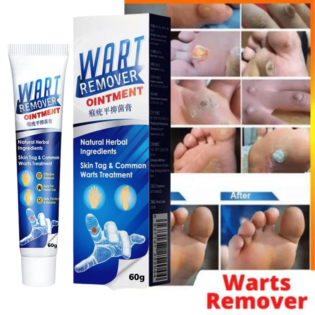Wart Remover Cream For Blackhead remover, Pimple remover, Dead skin remover Cream Wart Remover Cream For Blackhead remover, Pimple remover, Dead skin remover Cream