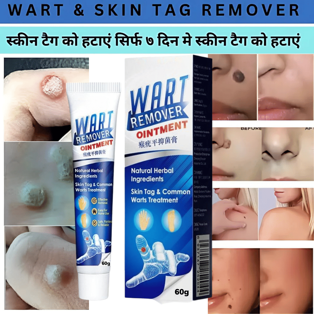 Wart Remover - Painless and Scar-Free Solution Use For Men & Women