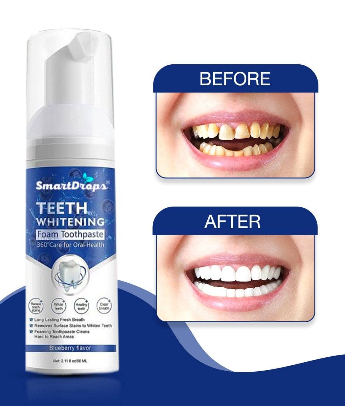 Smartdrops Standard Oral Kit