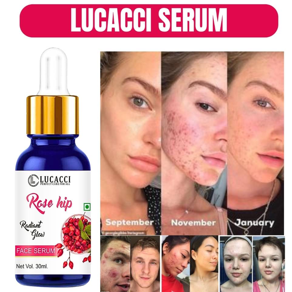     			LUCACCI Face Serum Vitamin E Pigmentation Reducing For All Skin Type ( Pack of 1 )