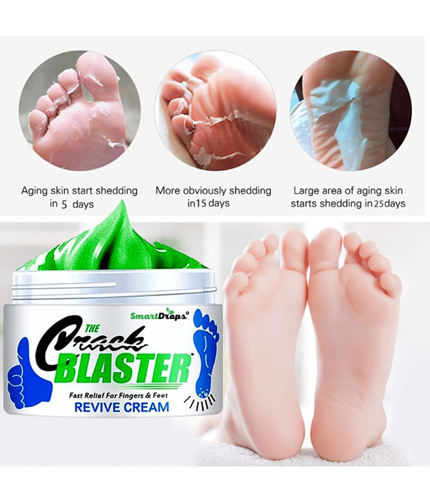 Smartdrops Chapped Hand And Foot Cream Crack Peeling Repair Anti Dry Skin Remove Dead Skin Foot Moisturizing (50gm) (For Women and men) Pack of 3