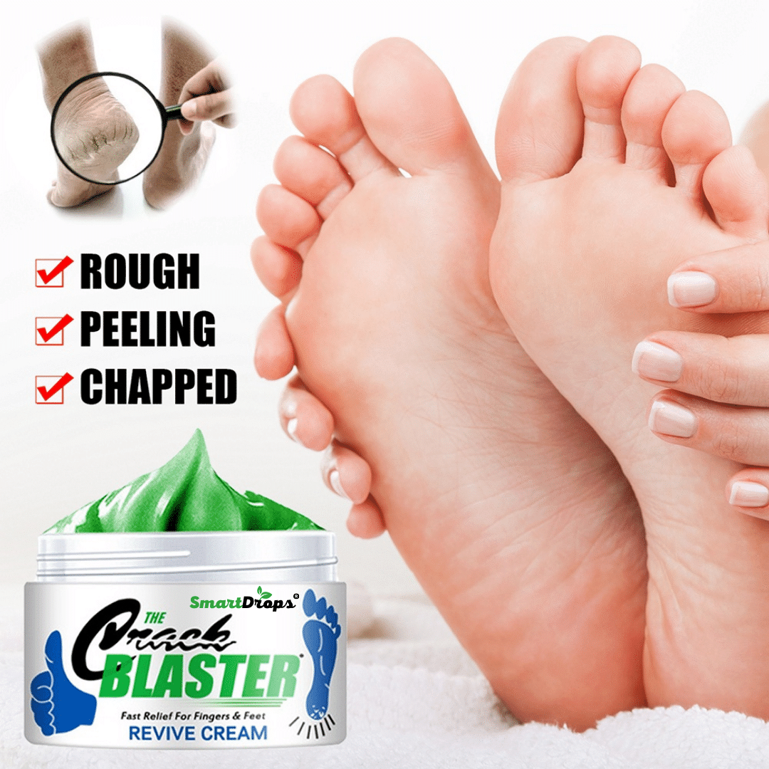 Smartdrops Softens For Dry & Cracked Feet Foot Cream Foot Cream ( 50 g ) Smartdrops Softens For Dry & Cracked Feet Foot Cream Foot Cream ( 50 g )