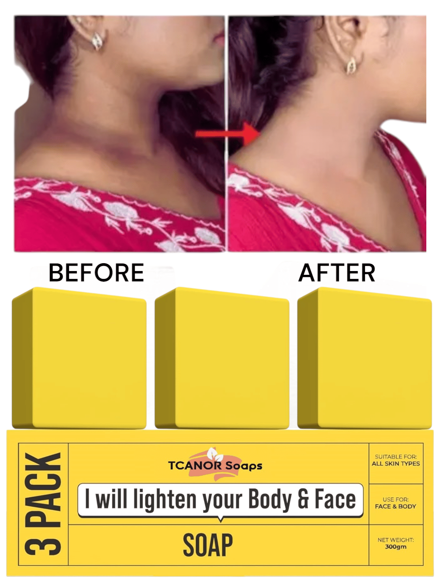 TCANOR Skin Whitening Bathing Bar for Normal Skin ( Pack of 3 ) TCANOR Skin Whitening Bathing Bar for Normal Skin ( Pack of 3 )