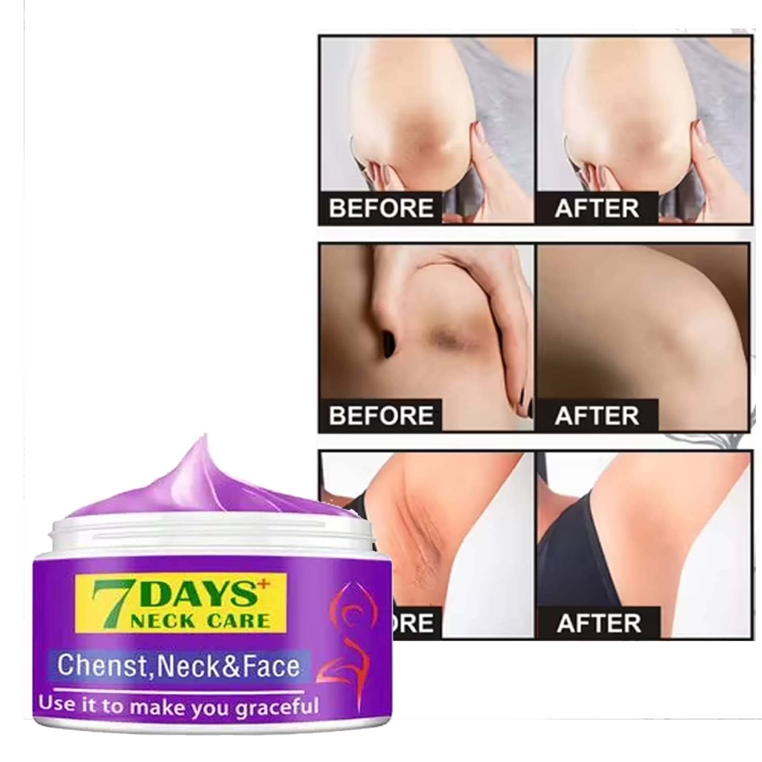 Treszo Black & White Head Removal Cream ( 50 g )