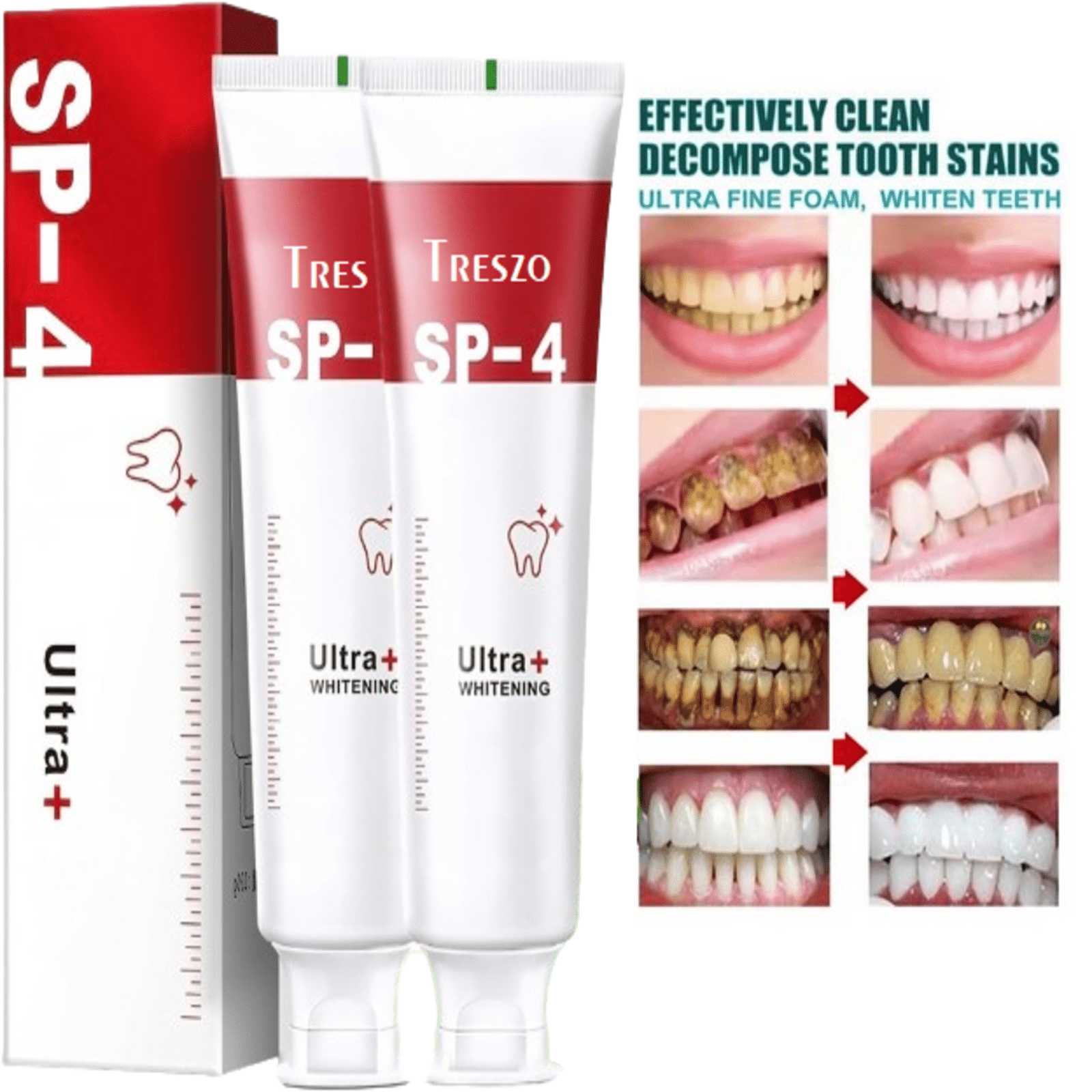 Treszo Whitening Toothpaste Pack of 2 Treszo Whitening Toothpaste Pack of 2