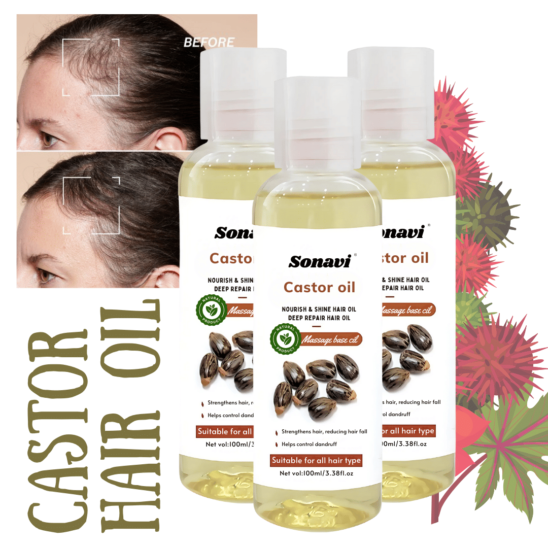 Sonavi Anti Hair Fall Castor Oil 100 ml ( Pack of 3 )     			Sonavi Anti Hair Fall Castor Oil 100 ml ( Pack of 3 )
