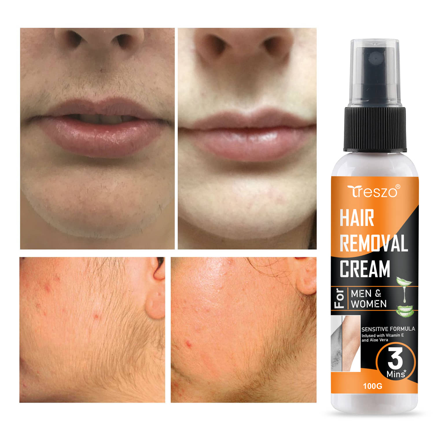 Treszo Natural Hair Removal Cream for Men & Women 100 ( Pack of 1 )