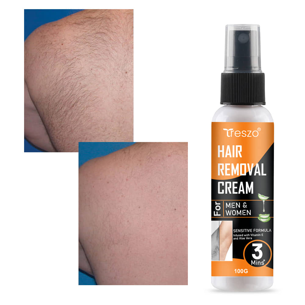 Treszo Natural Hair Removal Cream for Men & Women 100 ( Pack of 1 )