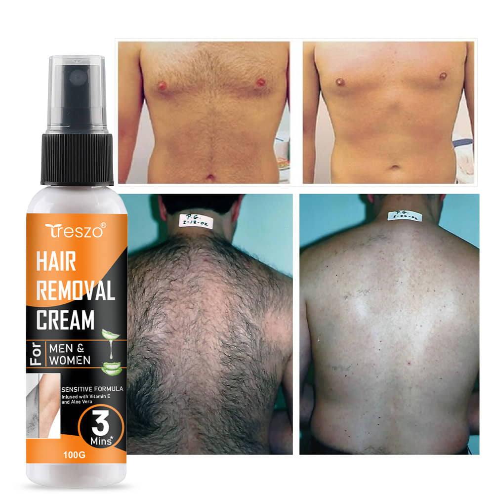 Treszo Natural Hair Removal Cream for Men & Women 100 ( Pack of 1 )