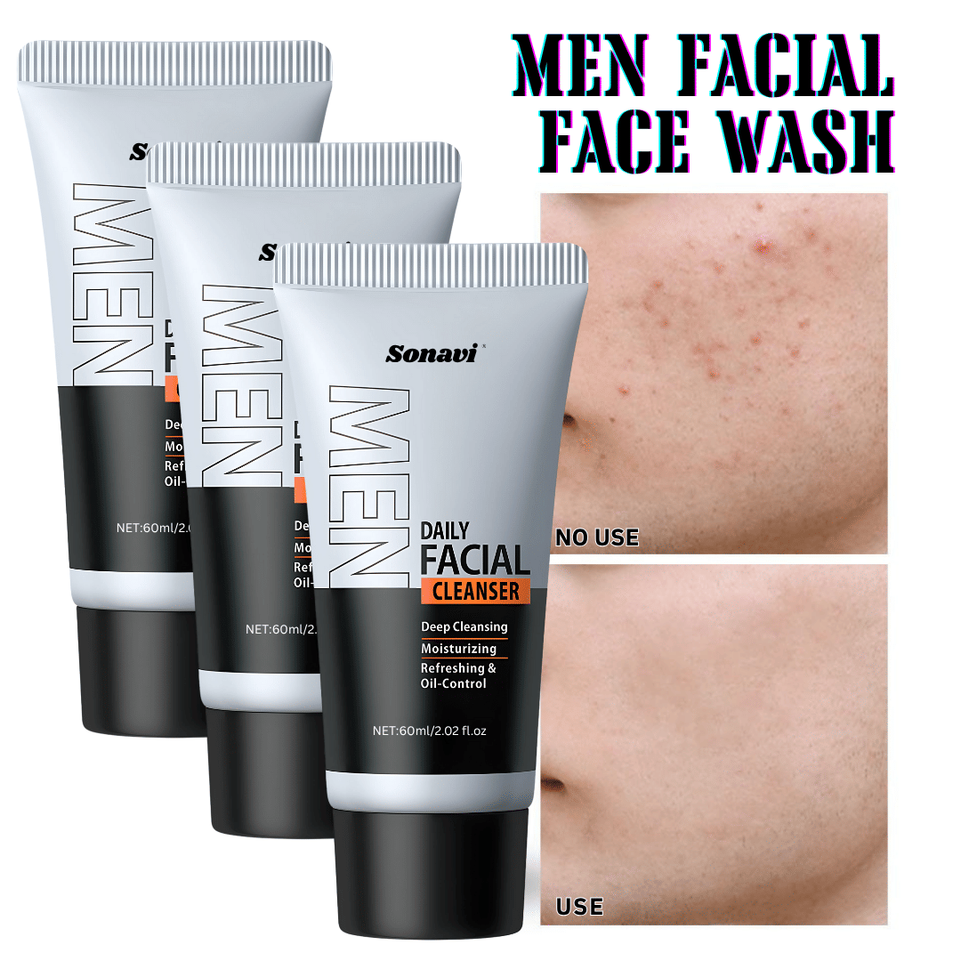 Sonavi Acne or Blemishes Removal Face Wash For All Skin Type ( Pack of 3 ) Sonavi Acne or Blemishes Removal Face Wash For All Skin Type ( Pack of 3 )