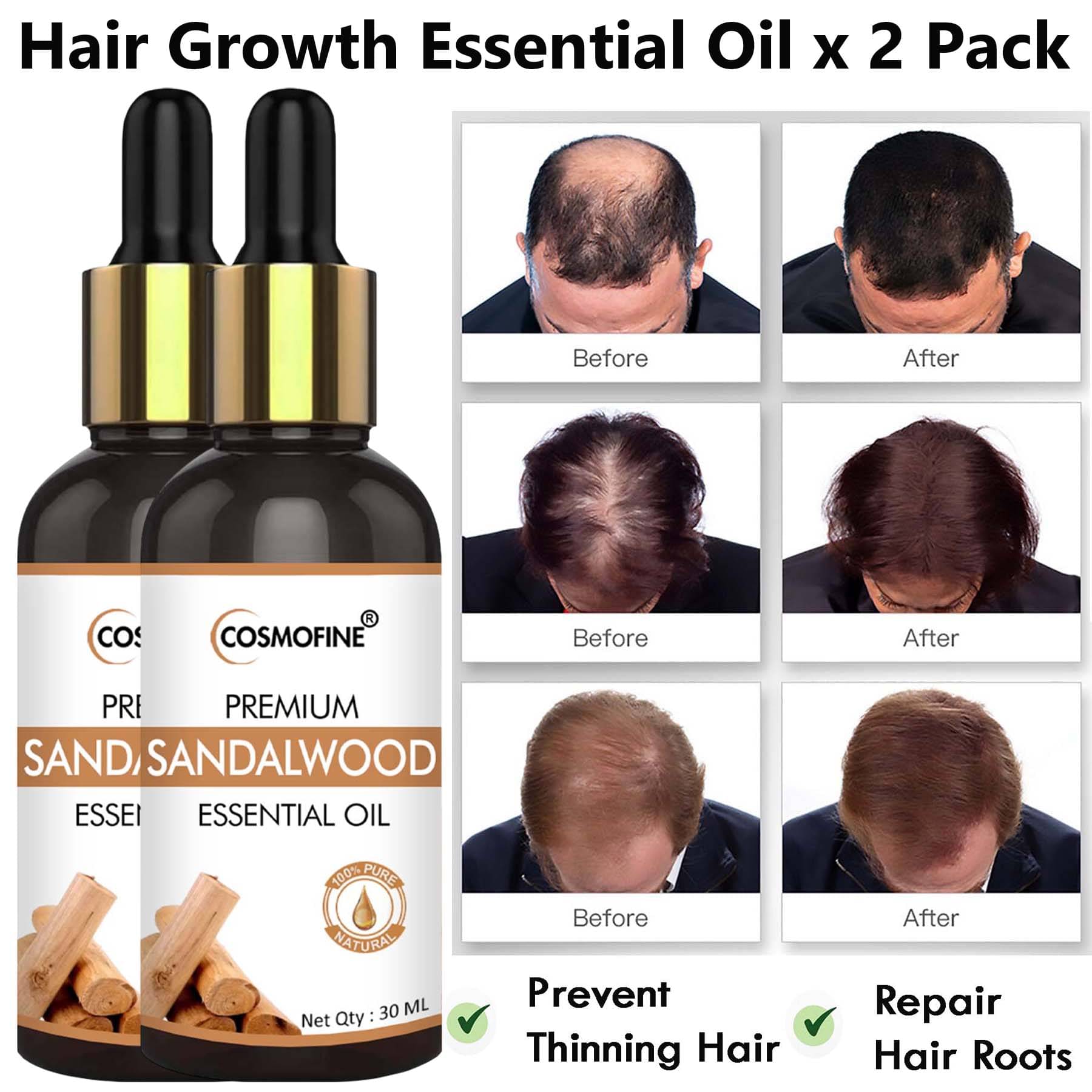     			COSMOFINE Anti Hair Fall Bhringraj Oil 30 ml ( Pack of 2 )