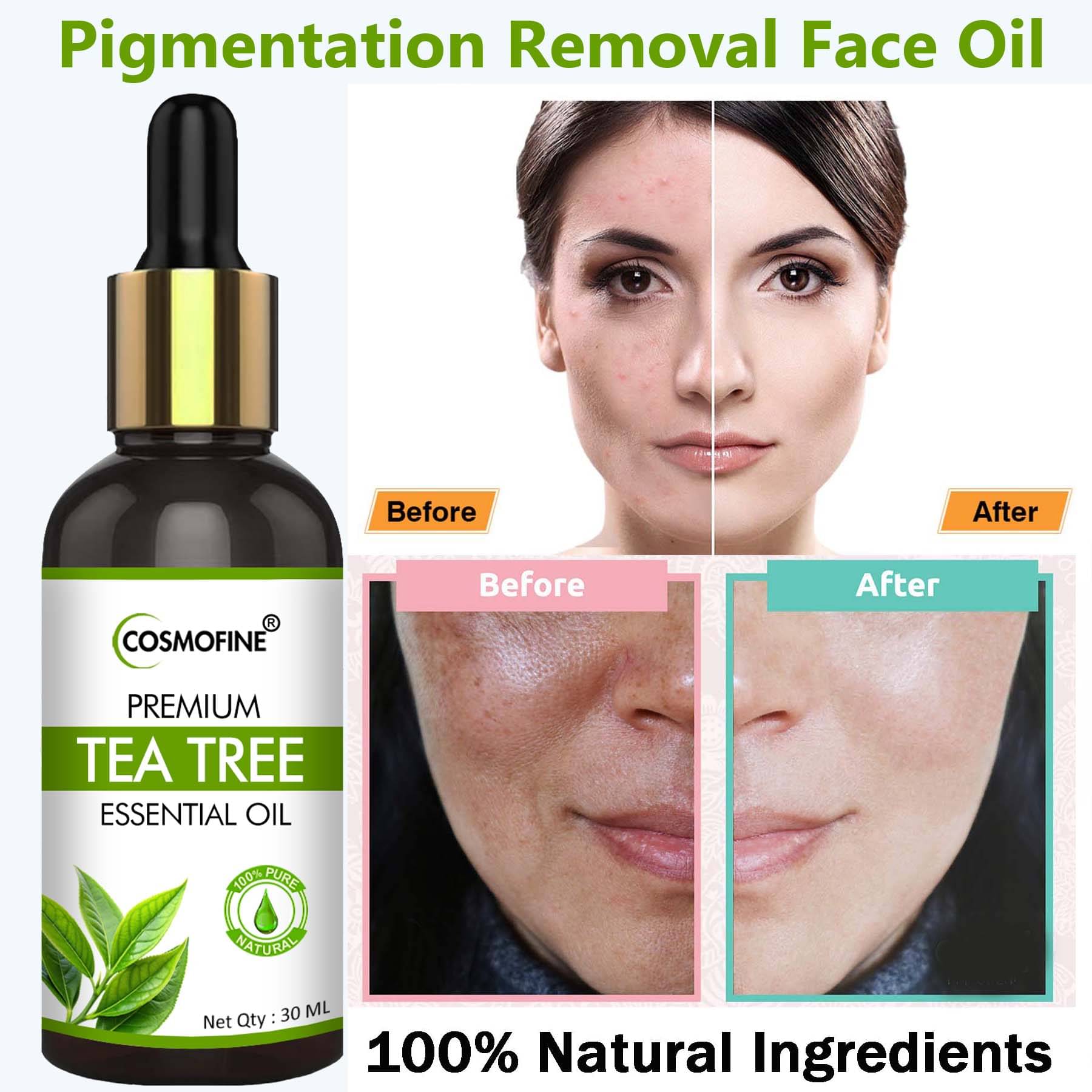     			COSMOFINE Face Serum Tea Tree Pigmentation Reducing For All Skin Type ( Pack of 1 )