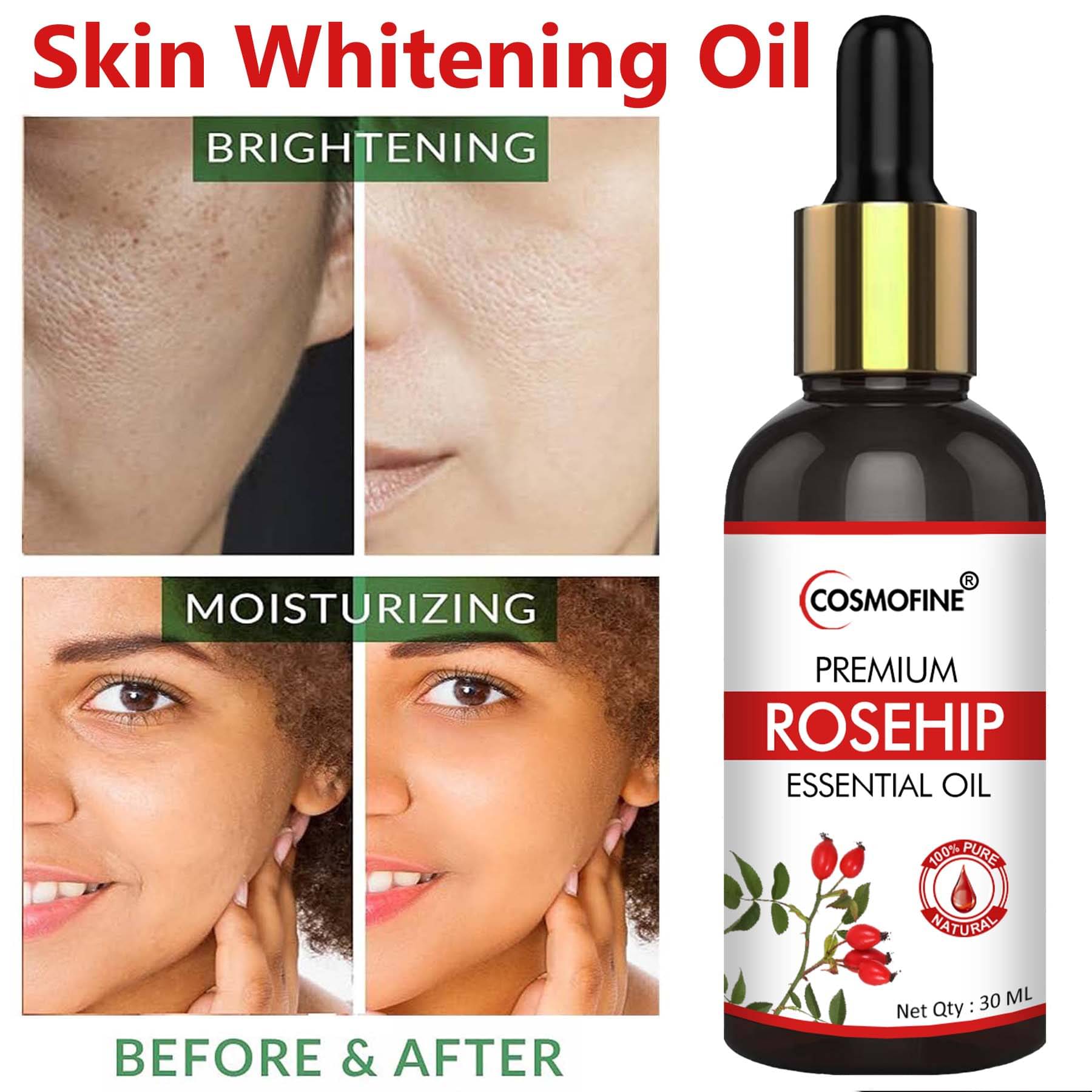 COSMOFINE Moisturizer All Skin Type Rosehip Oil ( 30 ml )     			COSMOFINE Moisturizer All Skin Type Rosehip Oil ( 30 ml )