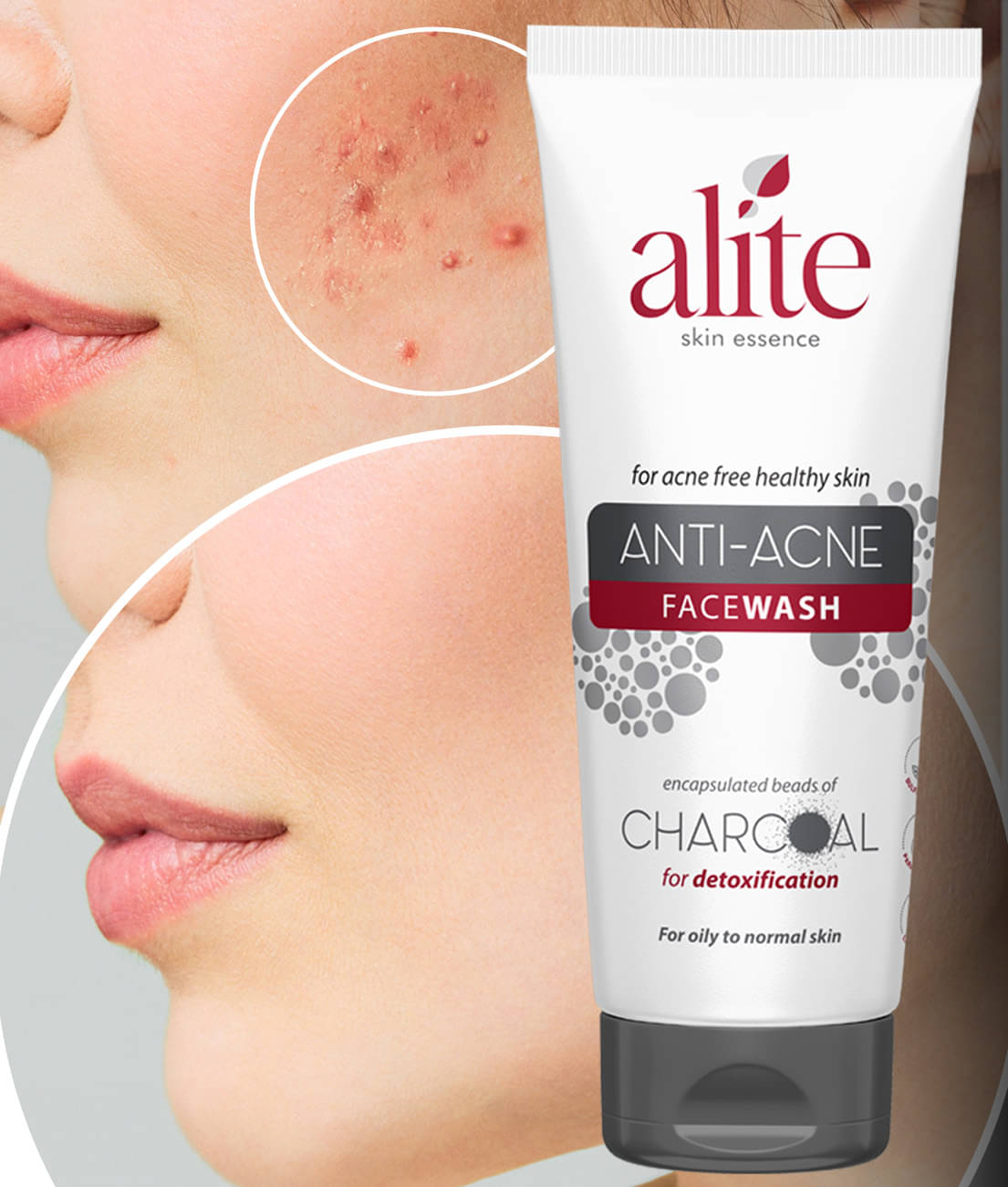     			Alite - Acne or Blemishes Removal Face Wash For All Skin Type ( Pack of 1 )
